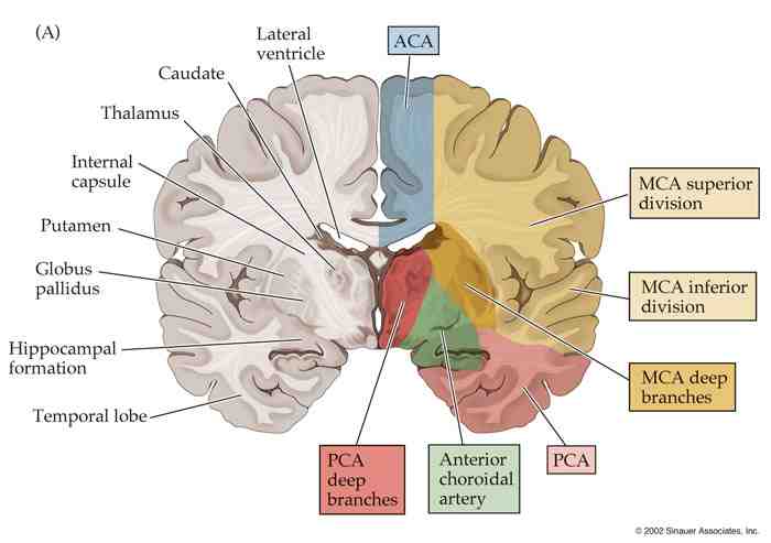 Brain perfusion diagram 1