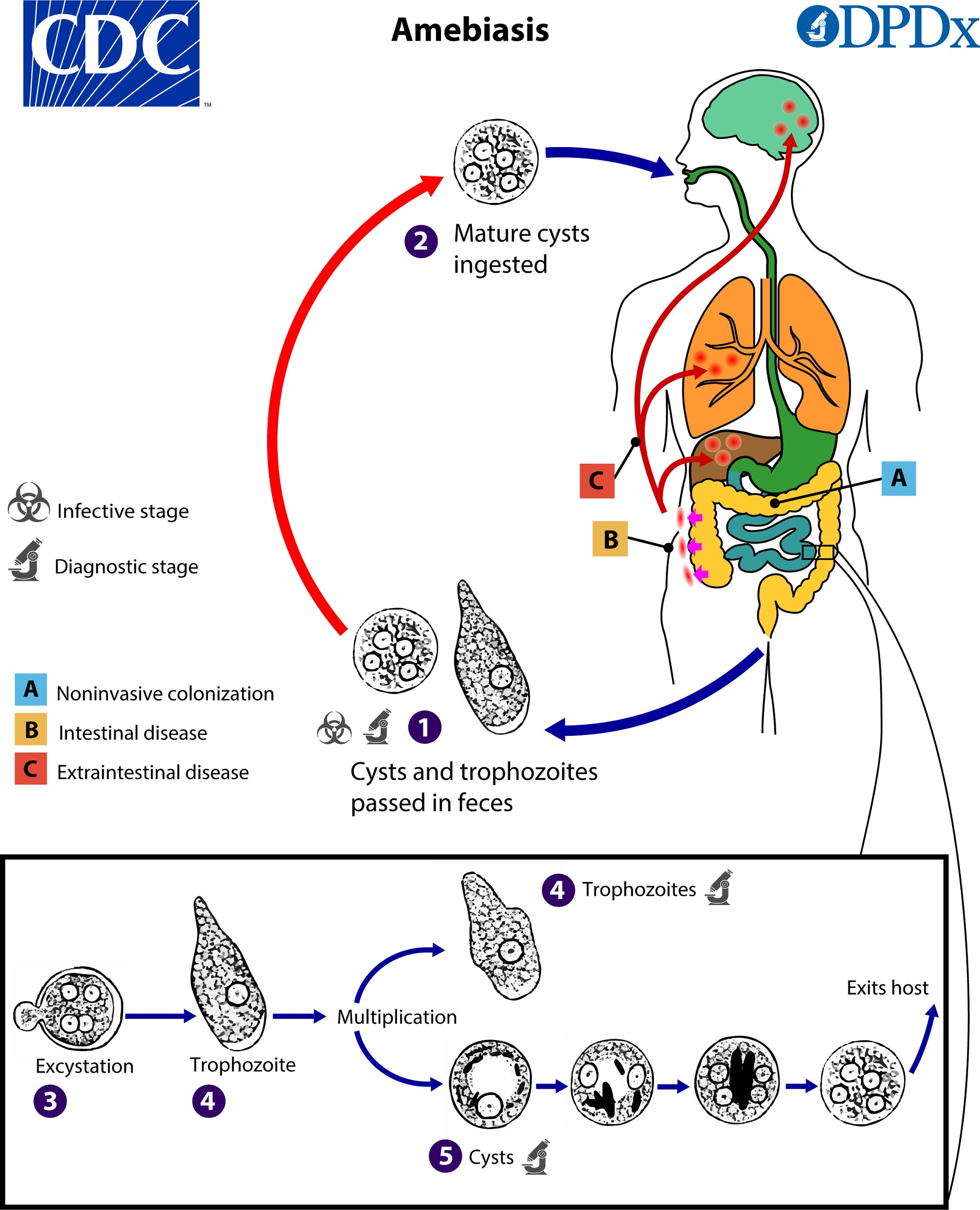 Amoebiasis image