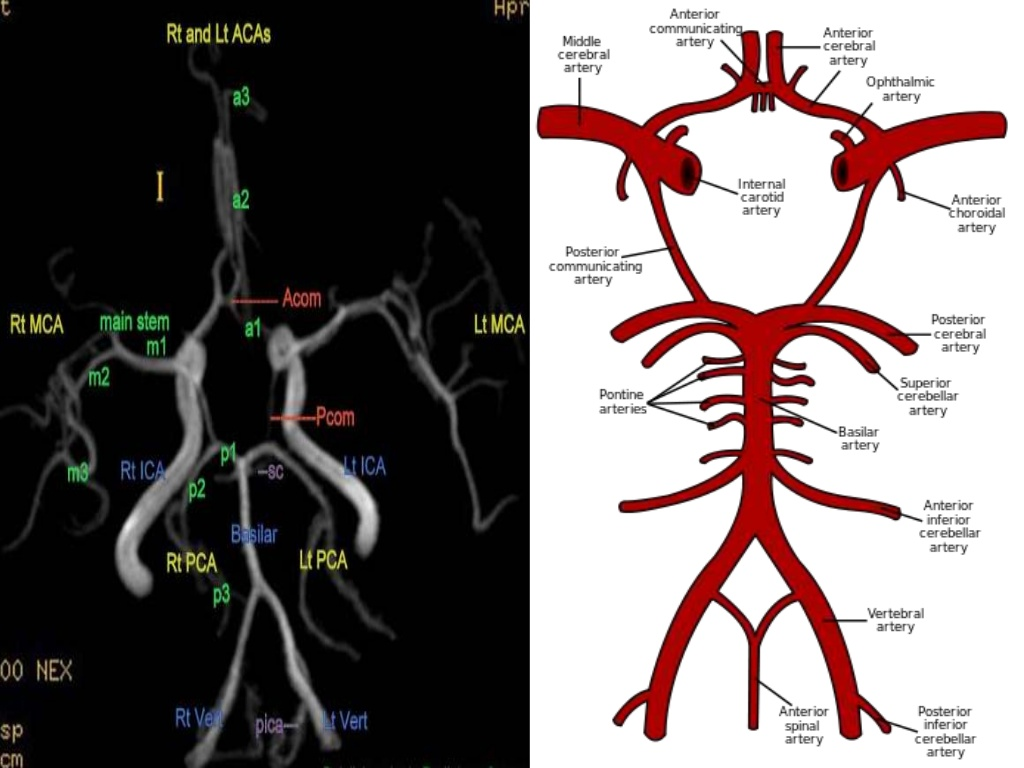 Brain blood supply diagram