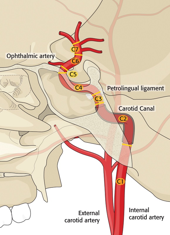 Carotid artery diagram 1