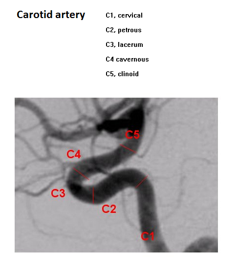 Carotid artery anatomy