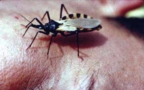 Chagas disease image