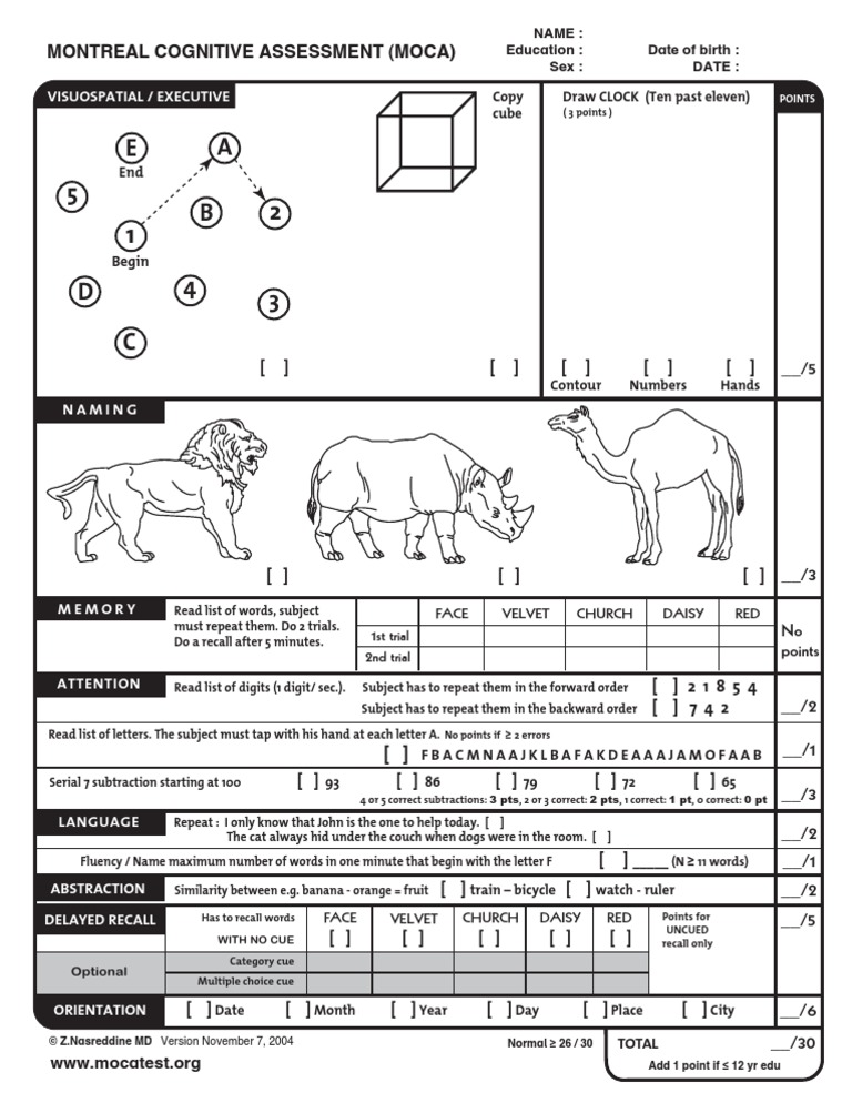 Montreal Cognitive Assessment (MoCA) Diagram