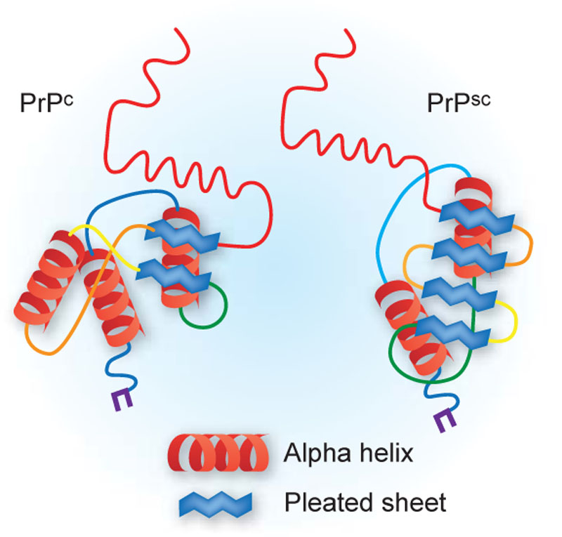 Prion Disease Image