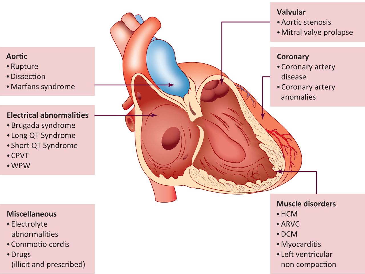 Sudden Cardiac Death Image