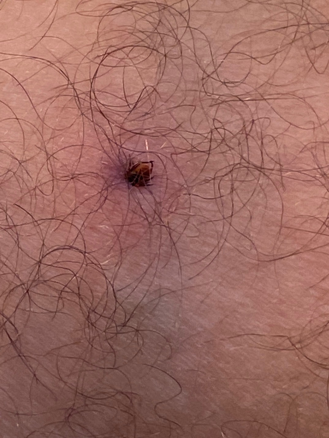 Tick Image
