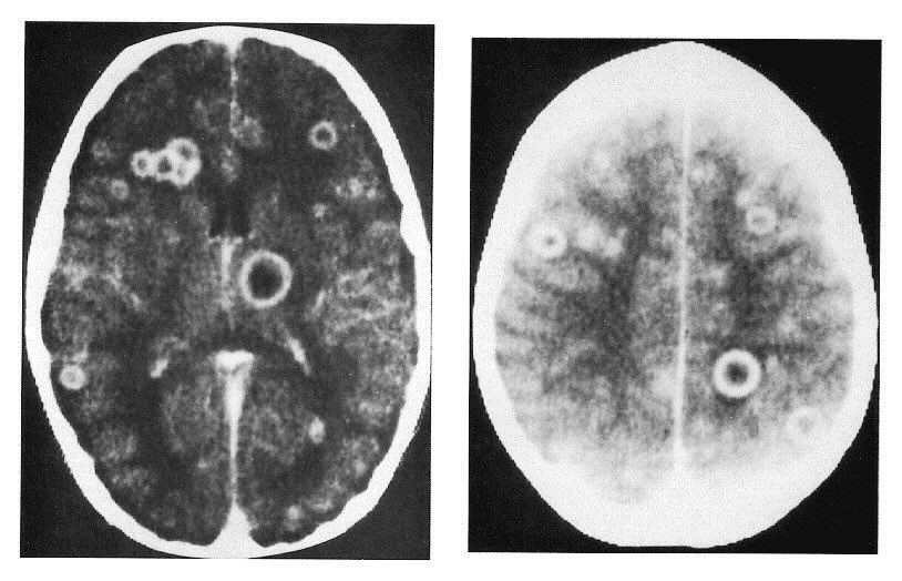 Toxoplasma image