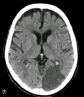 PCA territory schematic