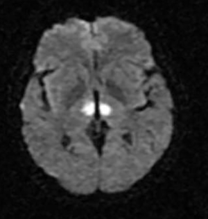 AOP territory schematic