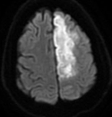ACA territory schematic