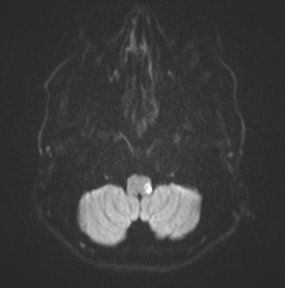 PICA territory schematic