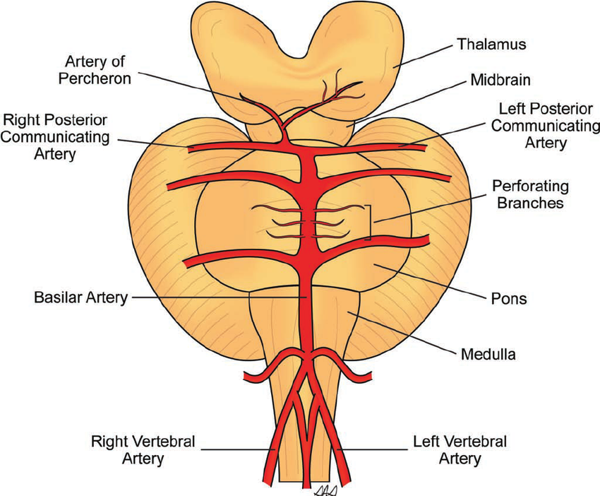 Artery of Percheron anatomical variant