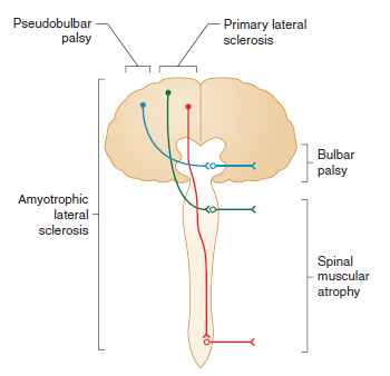 MND diagram