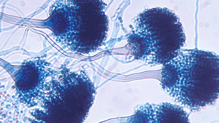 Aspergillus fumigatus histology