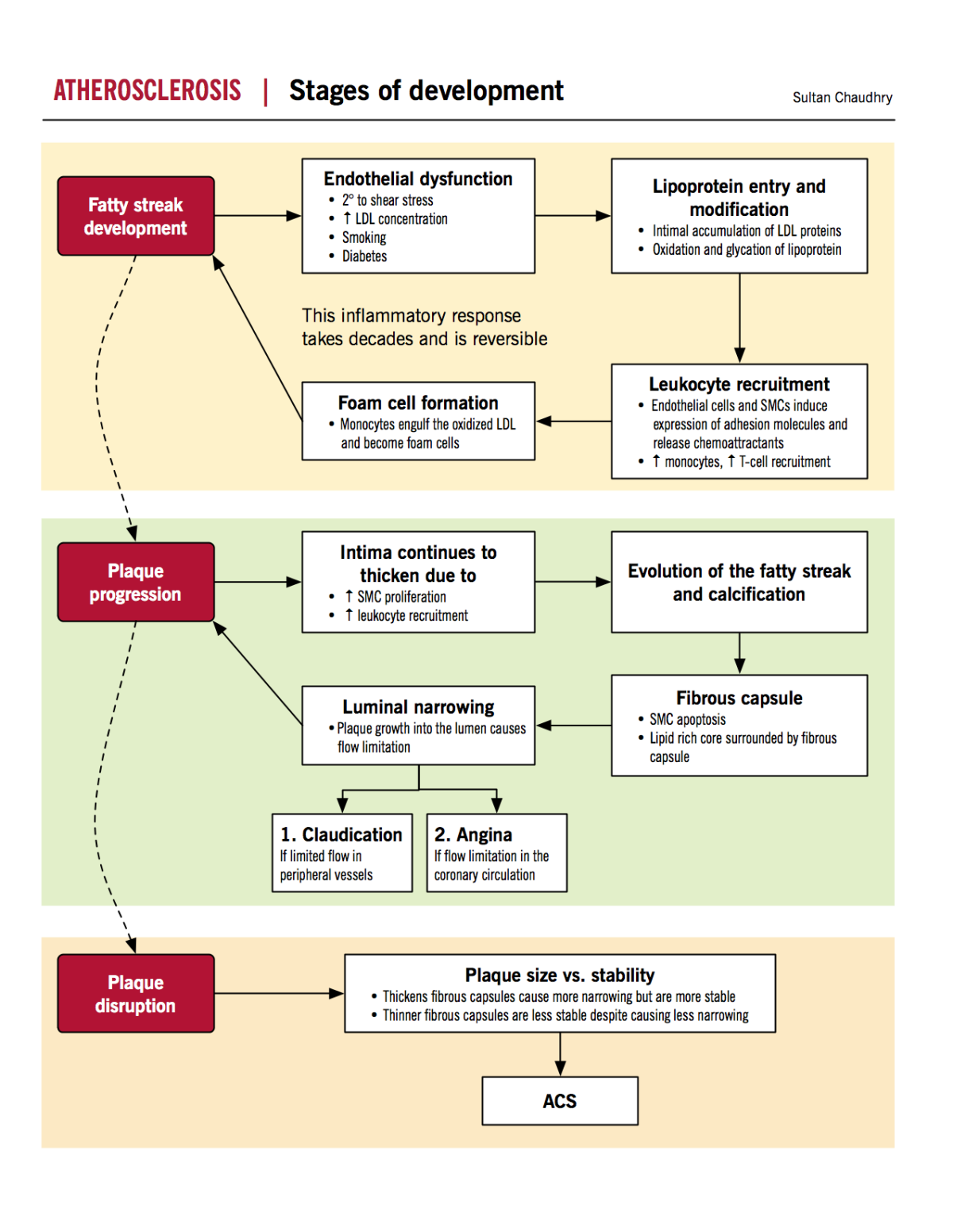 Atherosclerosis infographic