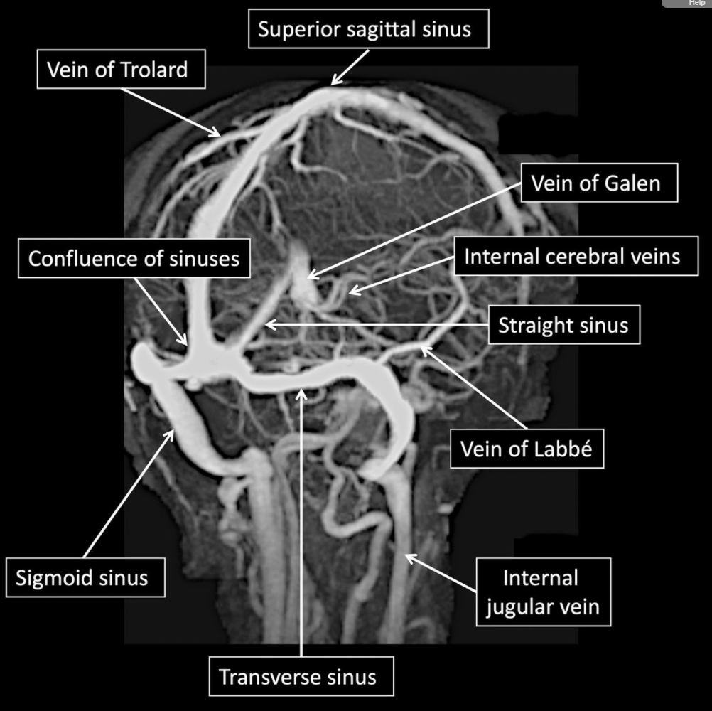 Brain venous drainage diagram 2