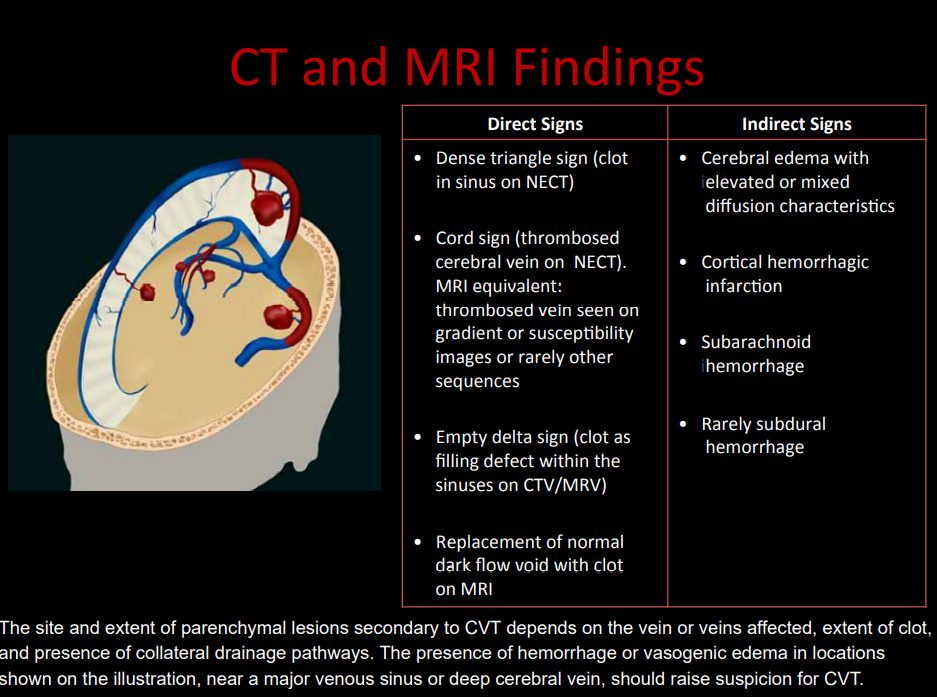 Brain venous drainage diagram 4