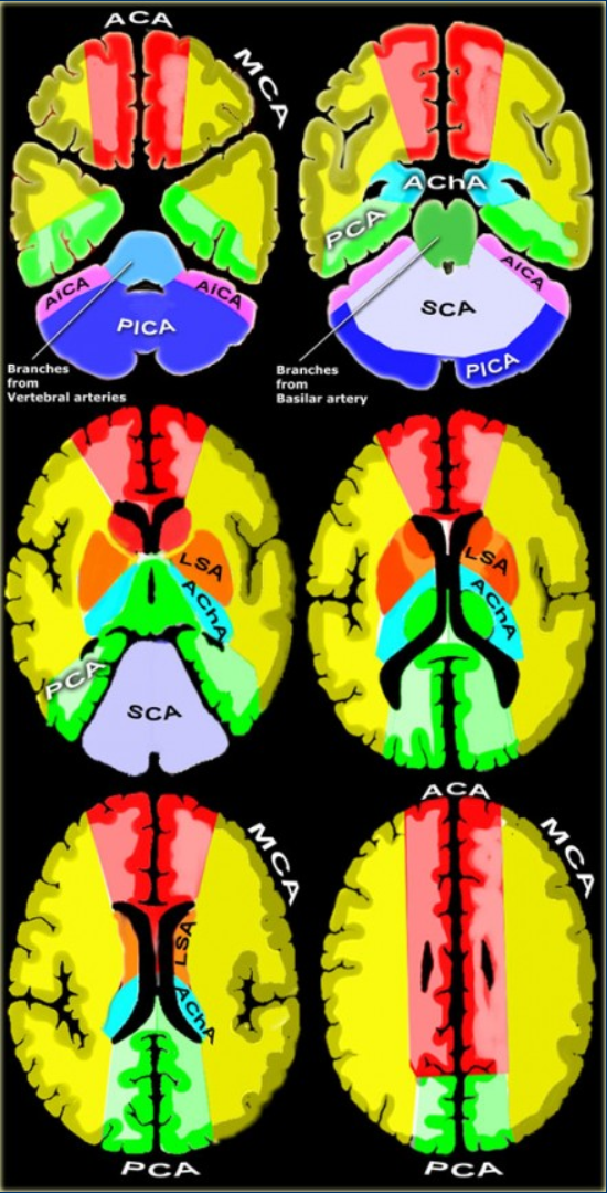 Brain Vascular Territories