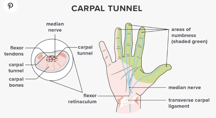 Carpal tunnel diagram