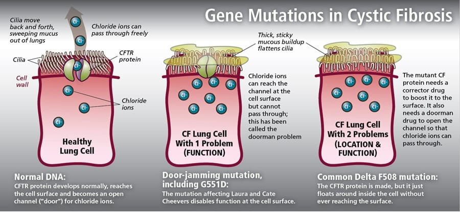 CFTR gene mutation diagram