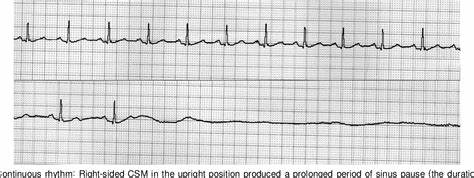 Monitoring during CSM