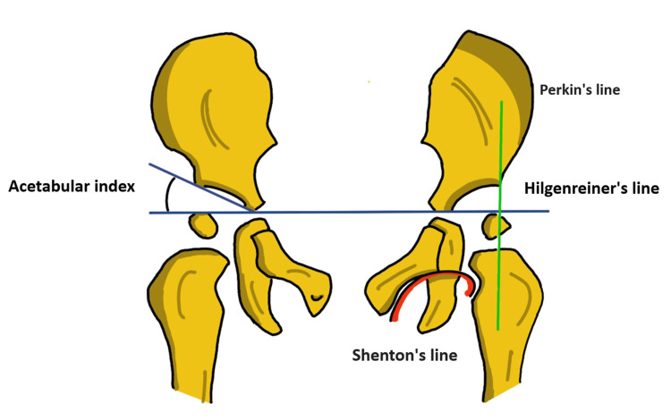DDH radiological lines