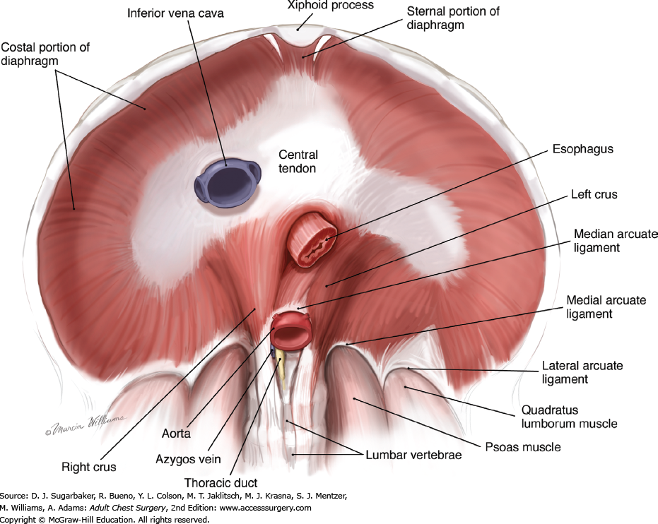 Diaphragm openings