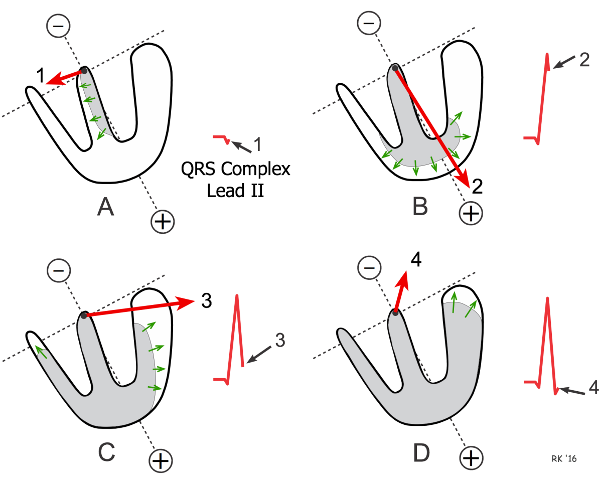 Normal QRS depolarisation