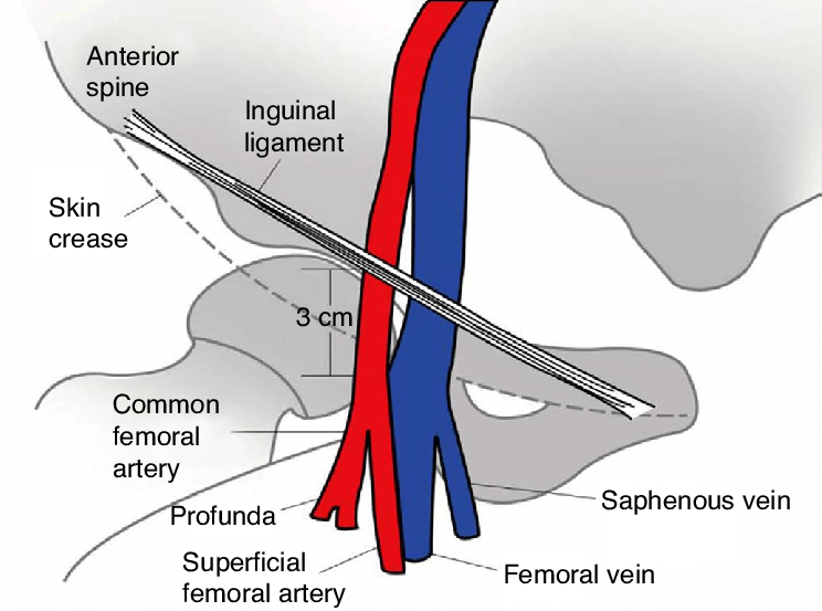 Femoral vein anatomy