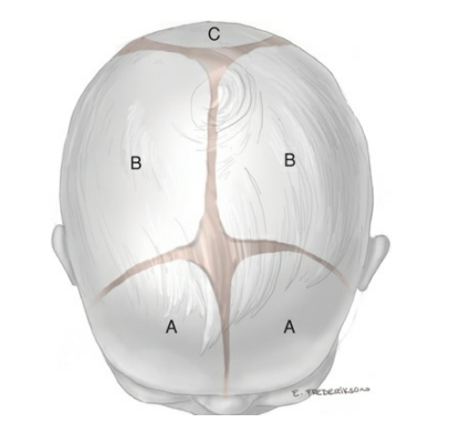 Fetal Skull Superior View