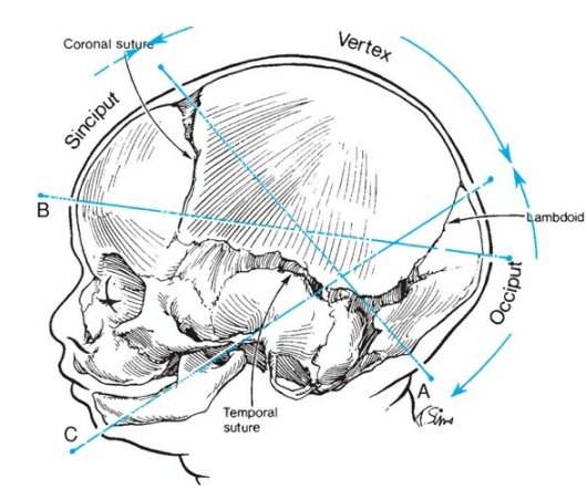 Fetal Skull Lateral View