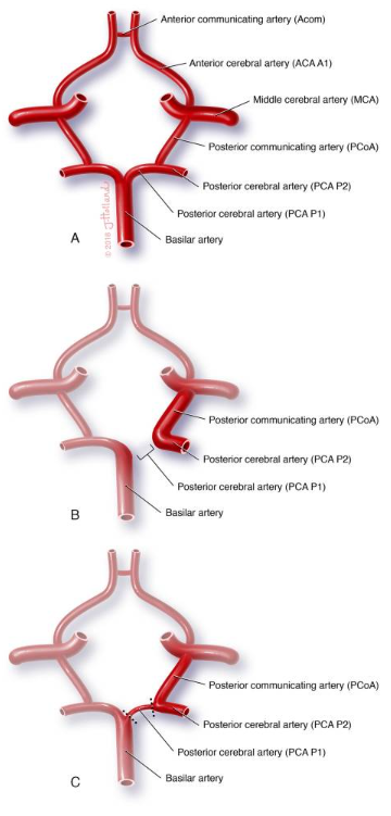 Fetal PCA variants