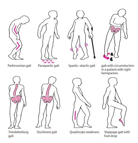 Gait Types
