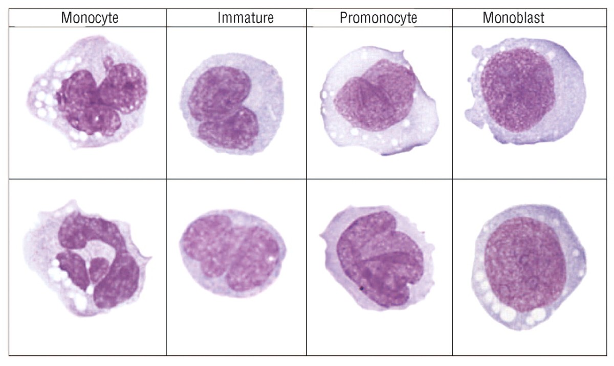 Monocyte under microscope