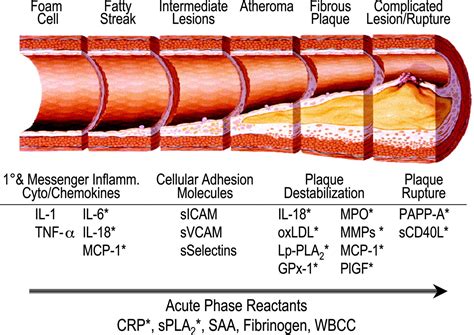 Plaque cross-section