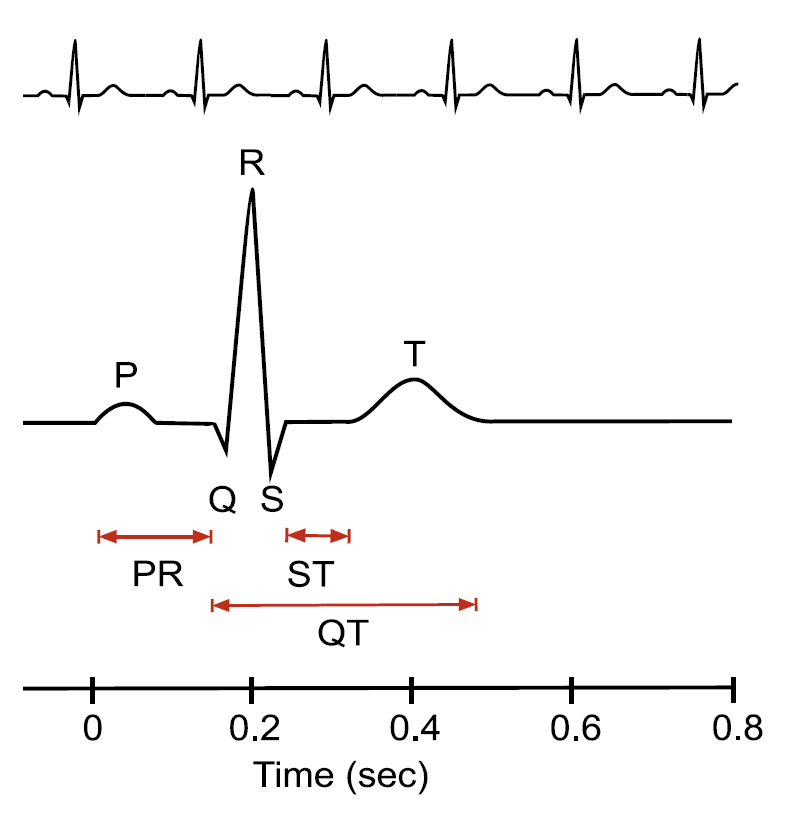 QT interval ECG diagram