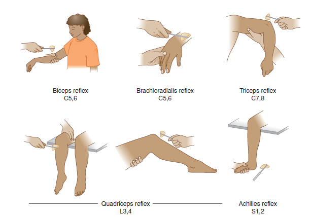 Reflexes diagram