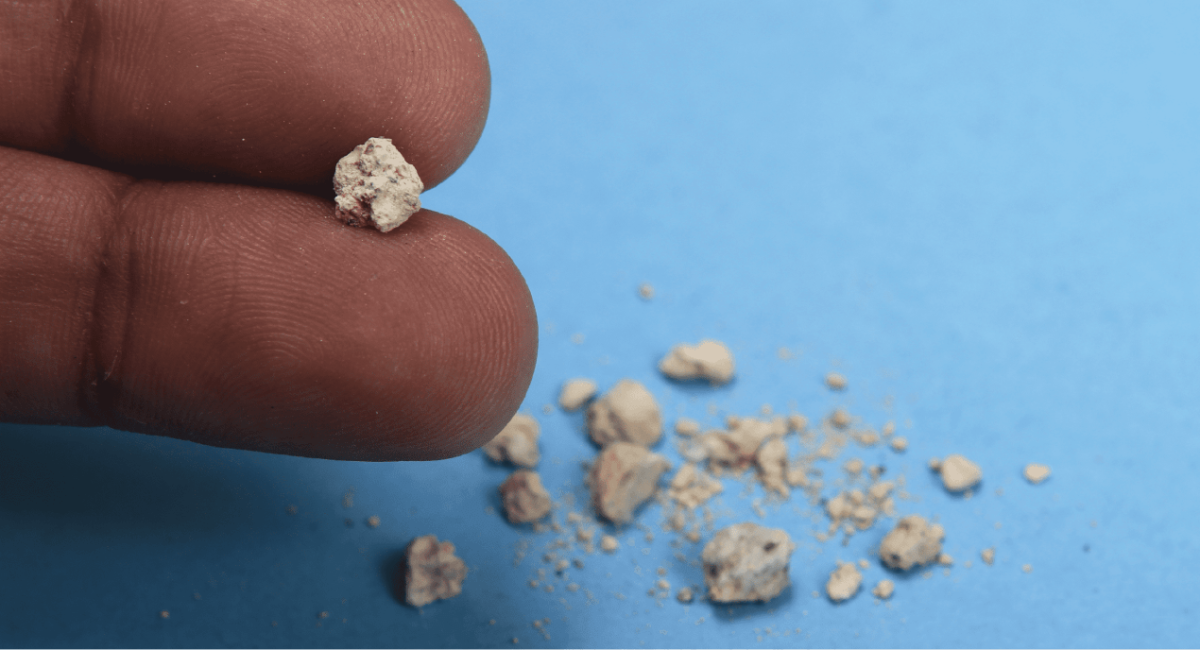Stone appearance