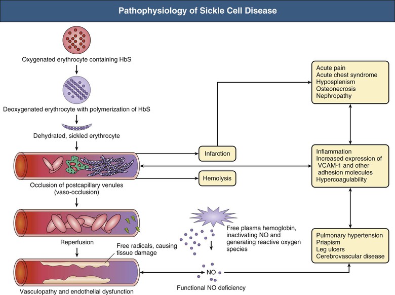 Sickle Cell Image