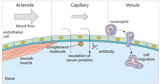 Stages of Acute Inflammation