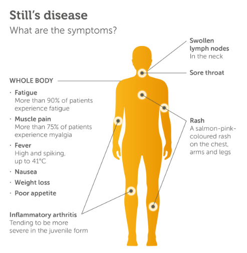 Salmon-coloured rash in Still's disease