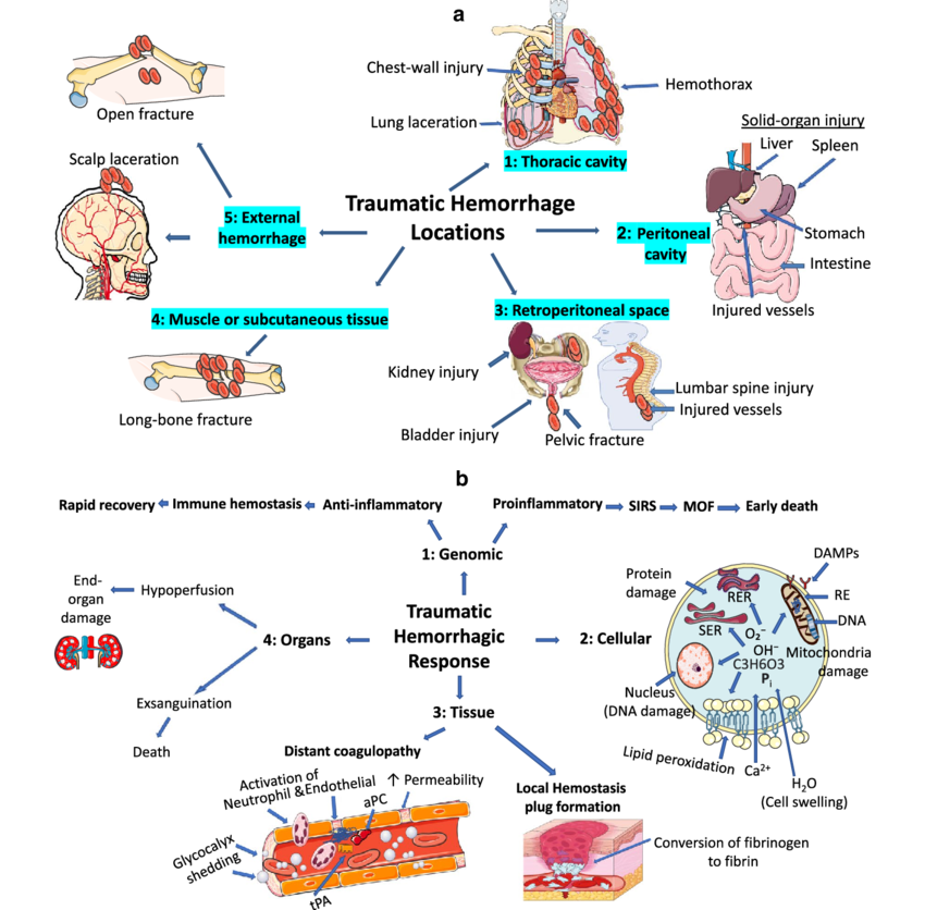 Trauma physiology diagram