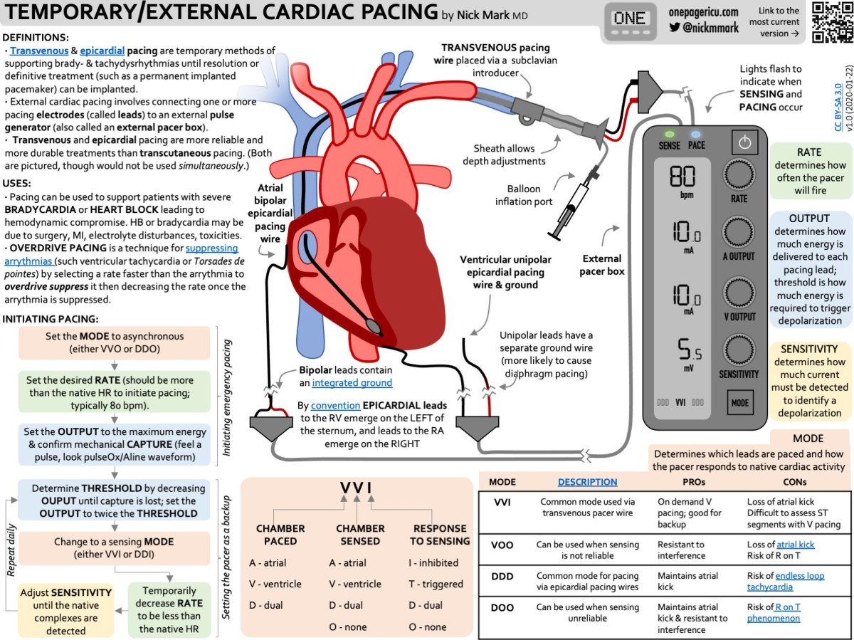 Temporary pacing wire chest x-ray